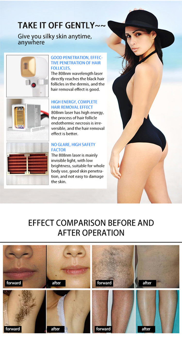 Rflaser 3 Wavelength Laser Hair Removal Diode Laser 500mw Diode Ice Laser Triple Wave Ice Hair Removal