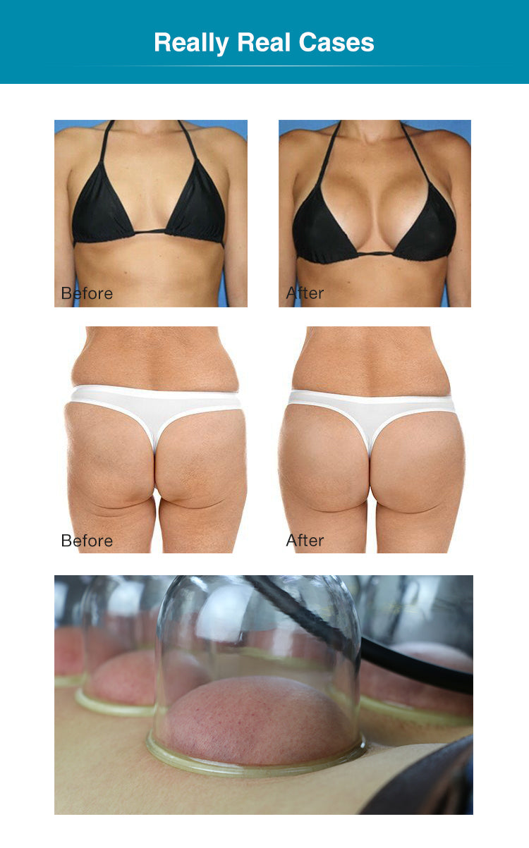 Body Massager Breast Enlargement & Butt Vacuum Therapy Machine
