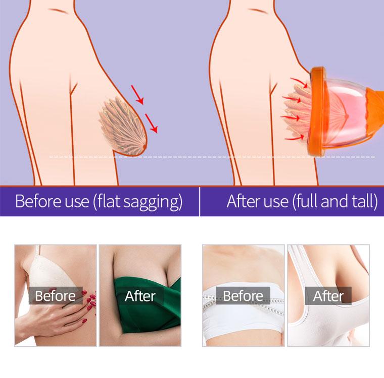 Buttock Enlargement Machine XXL Cup Massager Butt Lift Vacuum Therapy Machine