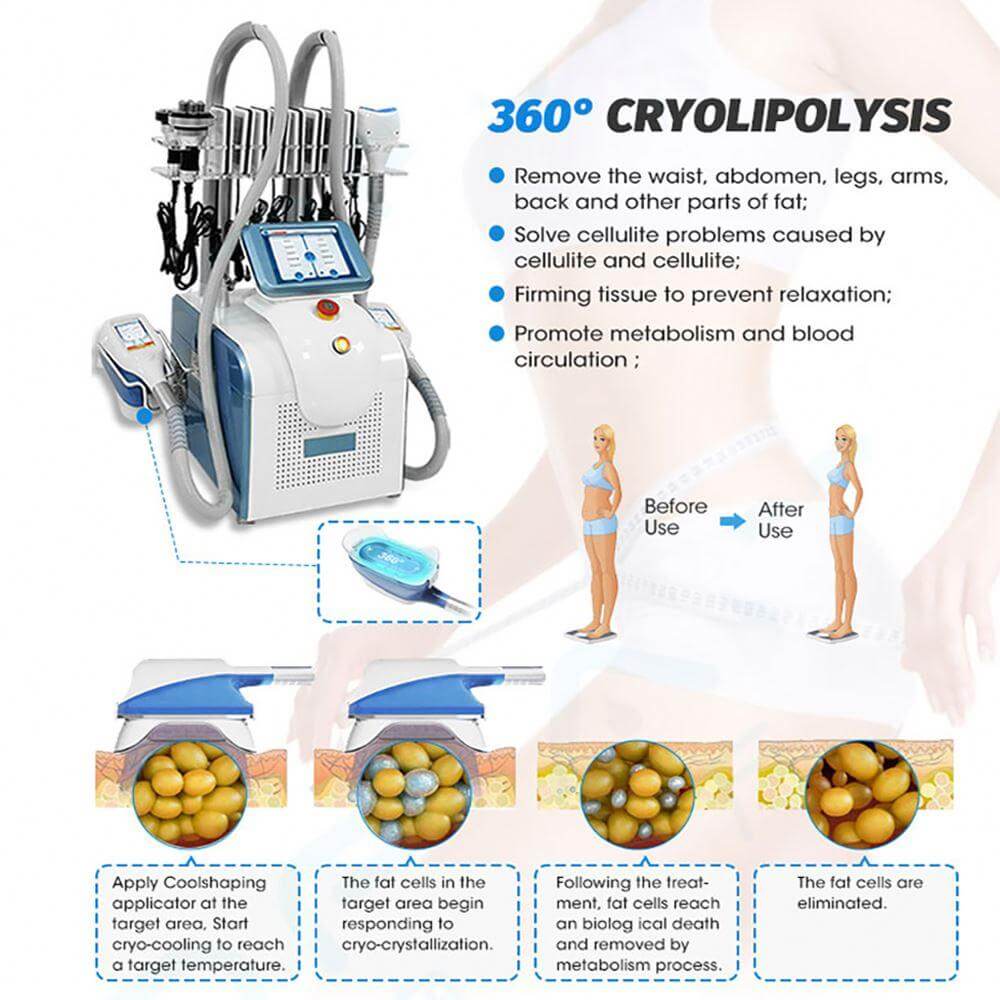 360 Cryo Handle for Fat Freezing Machine