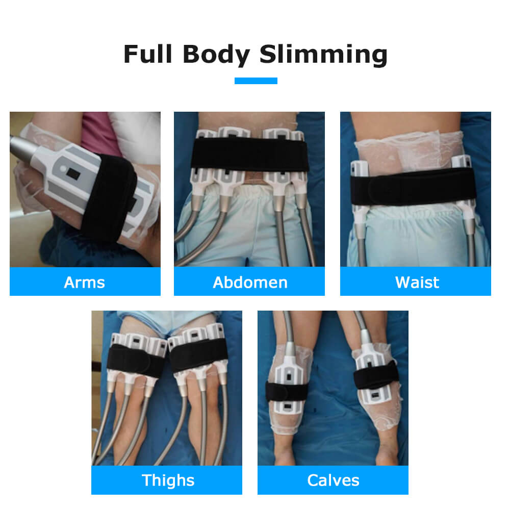 Cryolipolysis Slimming Machine for Non-Invasive Fat Loss