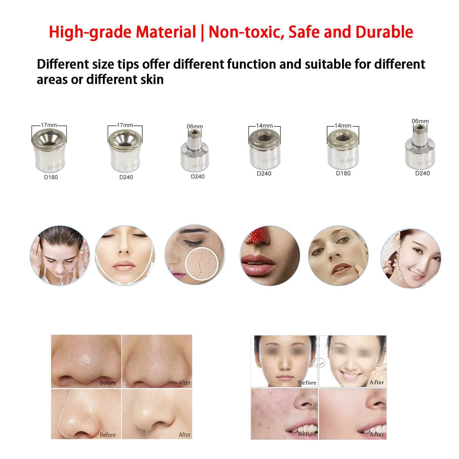 6pcs Dermabrasion Replacement Tips for Microdermabrasion Machine - Lazzybeauty