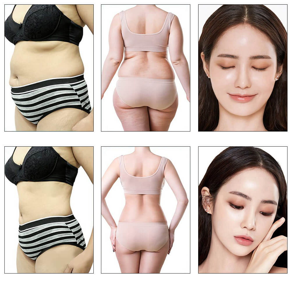 9 in 1 cavitation machine before and after
