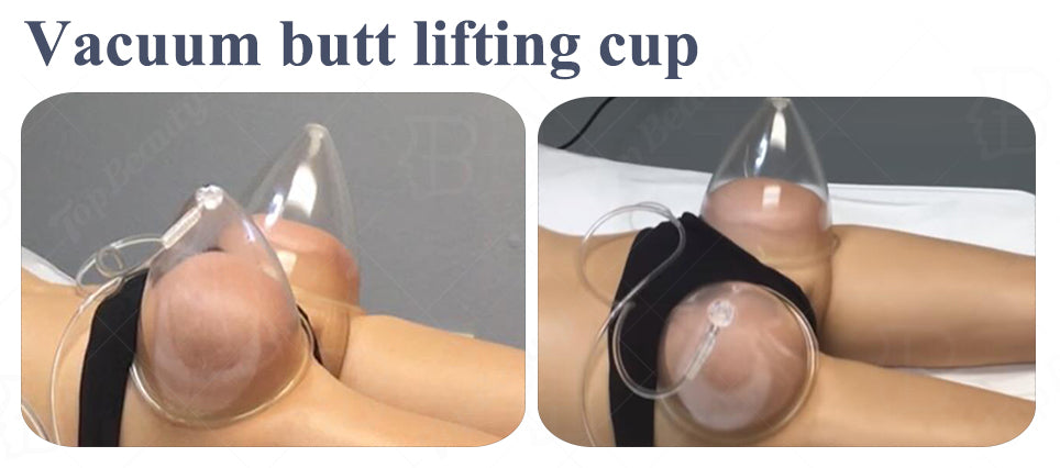Buttock Massage Suction Cupping Butt Enhancement Device
