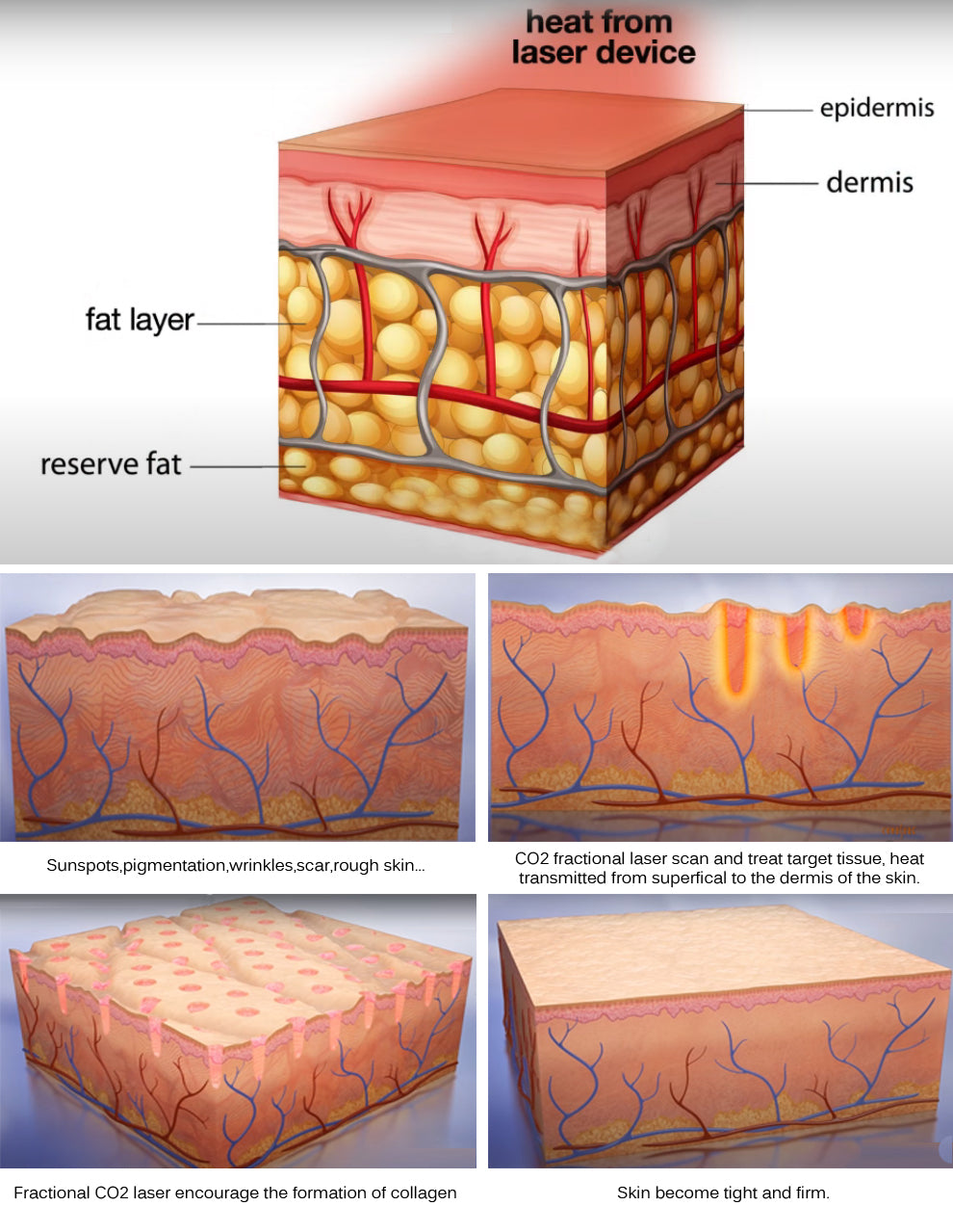 Carbon Dioxide Laser Fractional Co2 Laser Machine Laser Fractional Resurfacing Machines