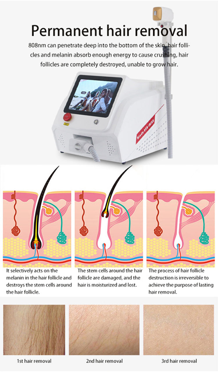 Rflaser 3 Wavelength Laser Hair Removal Diode Laser 500mw Diode Ice Laser Triple Wave Ice Hair Removal