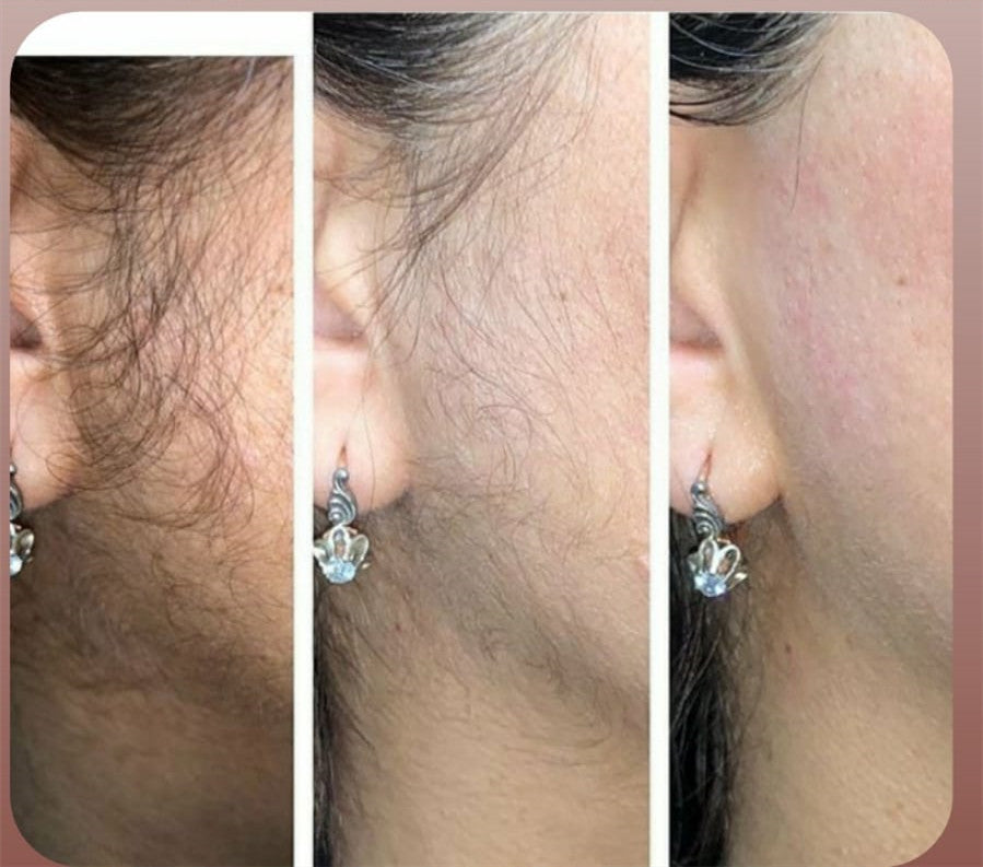 Diode Laser hair remove Portable depilacion laser 808nm hair salon equipment aesthetic diodo laser lazer hair removal machines
