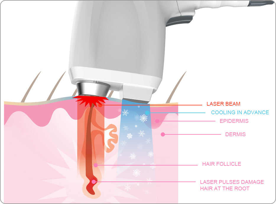 aesthetic machine beauty salon spa equipment diode laser removal High Intensity Diode Laser Hair Removal Machine