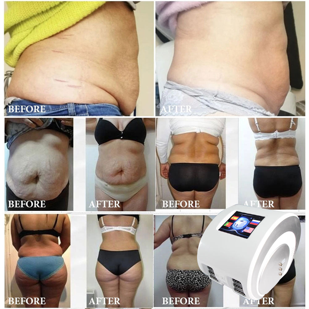 Pressotherapy Lymphatic Drainage Machine