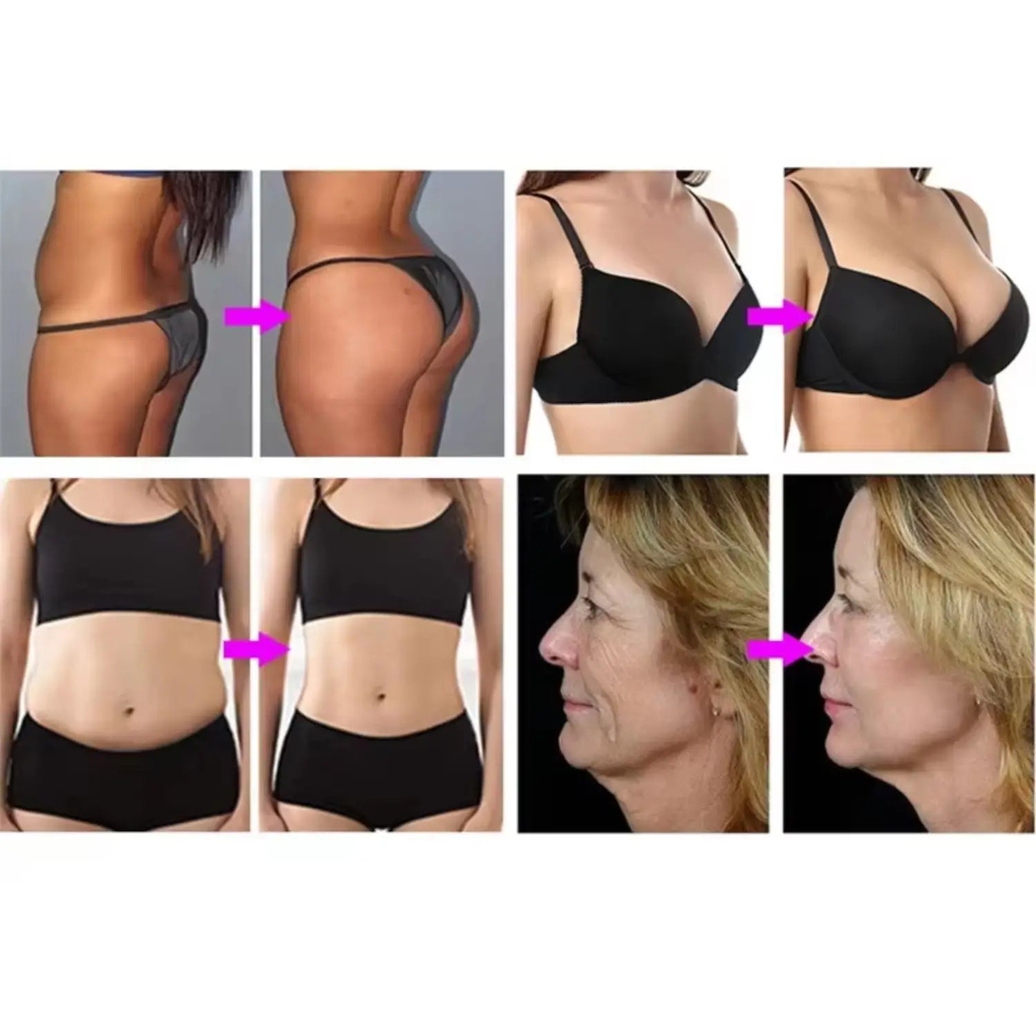 Butt Enhancement Machine – Vacuum Therapy & Body Shaping Device