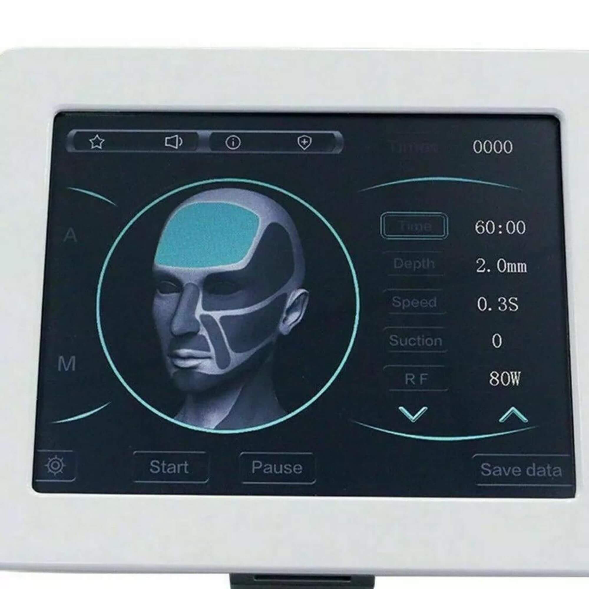 Professional RF Needling Machine for Skin Tightening & Wrinkle Reduction (Max. 3.5mm Depth)