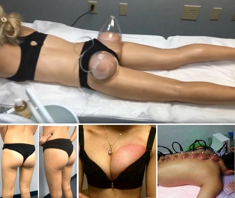 35 Cups Far Infrared Buttocks Enlargement Machine for Butt Hip Lifting