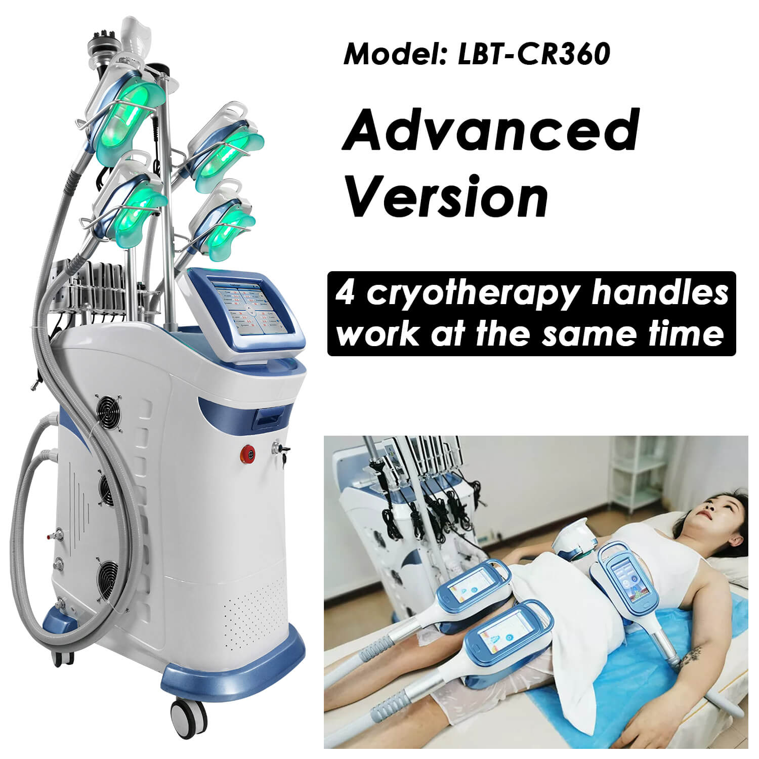 脂肪冷却マシン　Cryolipolysis 脂肪冷却マシーン・クライオ・キャビ・痩身 Cryolipolysis Amazon.co