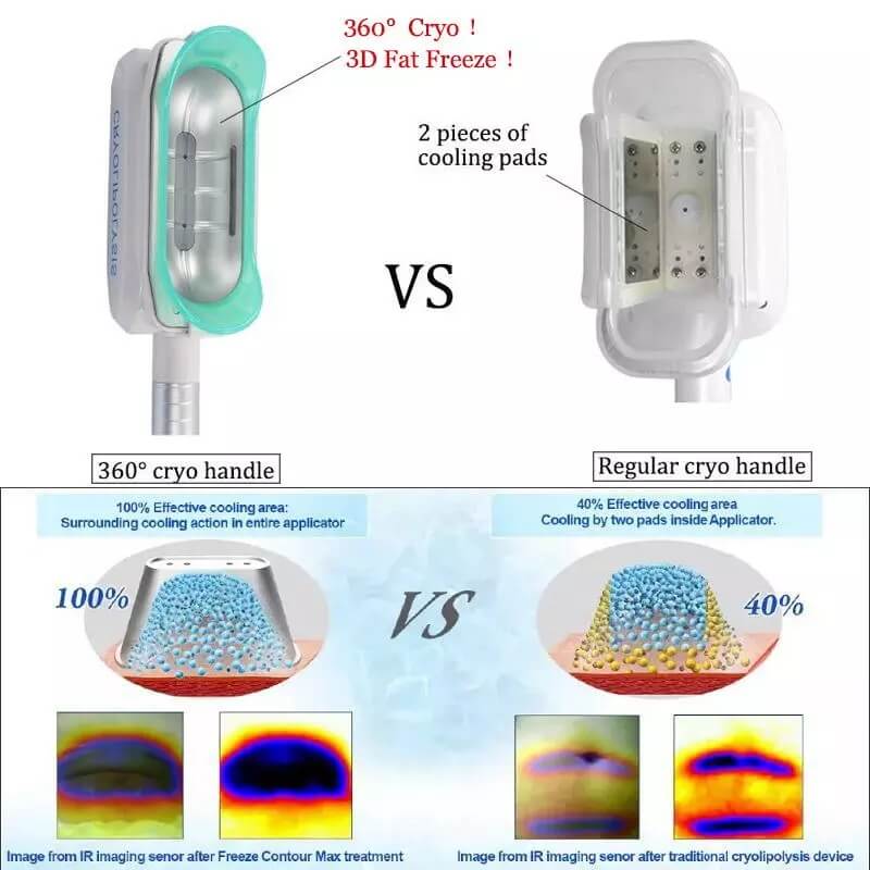 360 Cryo Handle for Fat Freezing Machine